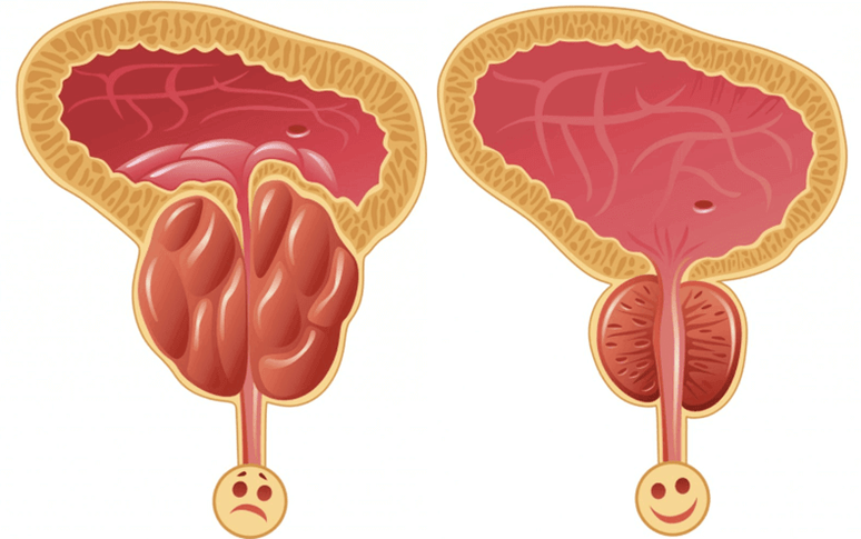 причини за проблеми с потентността при мъжете